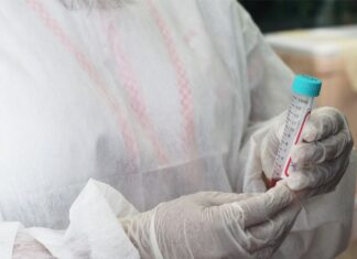 Cenário epidemiológico da Covid-19 no Amazonas é divulgado pela FVS-RCP, neste domingo (09/01)