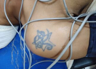 HPS João Lúcio pede apoio para localizar familiares de paciente vítima de agressão