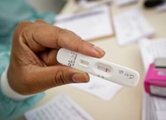 Autotestes são ferramentas complementares no diagnóstico para Covid-19, esclarece FVS-RCP
