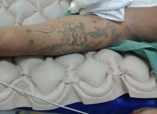 HPS Platão Araújo procura familiares de paciente internado na unidade