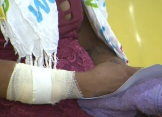 Homem é preso dentro de SPA após esposa pedir socorro por ter sido espancada a pauladas em Manaus