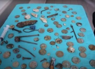 Médicos retiram 233 objetos do estômago de paciente, incluindo baterias, moedas, cacos de vidro e parafusos