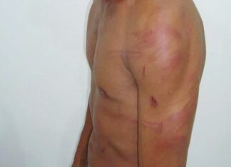 Amanhecida: Mulher passa a madrugada na rua bebendo e espanca o marido que reclamou