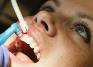 Profilaxia Dental Profissional o que há de mais moderno