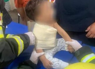 Bebê de 1 ano é socorrido após cravar espeto de churrasco no braço, no AM
