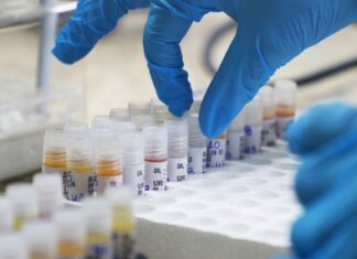 Saúde atualiza cenário da Covid-19, Monkeypox e vacinação no Amazonas nesta quarta-feira