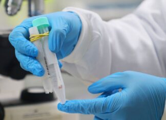 Amazonas informa boletins da Covid-19, Mpox e vacinação nesta sexta-feira (16/12)