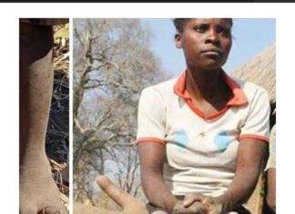 Os pés dos membros desta tribo africana são como garras de avestruz. Eles só têm dois dedos