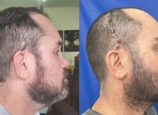 Após ter rosto deformado em assalto, cirurgia em hospital SUS devolve esperança e autoestima para paciente