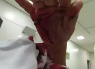 Brasil: Homem esfaqueia esposa no pescoço, fere filho de 9 anos e foge