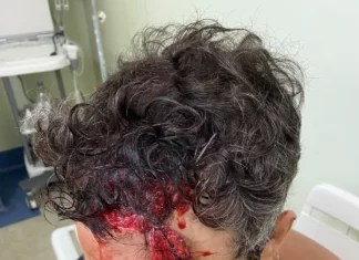 Ator Faz o L Thiago Rodrigues afirma que foi espancado por bandidos no Rio, mas internet desconfia dos fatos, veja