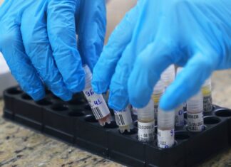 Mpox: novo inforcard atualiza cenário da doença no Amazonas, nesta terça-feira (07/02)