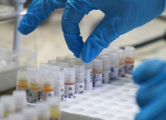 Mpox: Nova atualização não tem registro de caso confirmados da doença no Amazonas