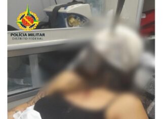 Jovem fica com faca cravada na cabeça e sobrevive após ser atacada, imagem forte