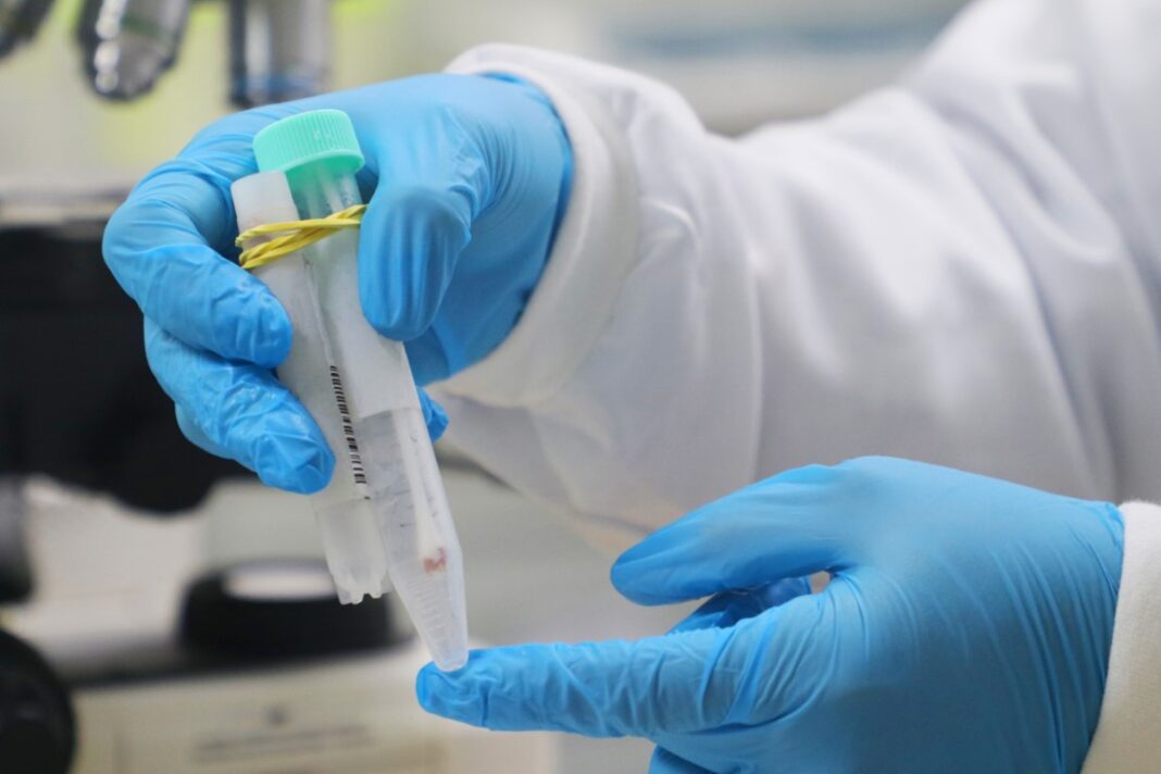 FVS-RCP_Diagnóstico Mpox_FOTO Girlene Medeiros FVS-RCP (1)