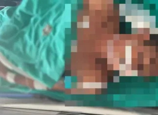 Homem é socorrido e sobrevive após ser encontrado com faca cravada no rosto