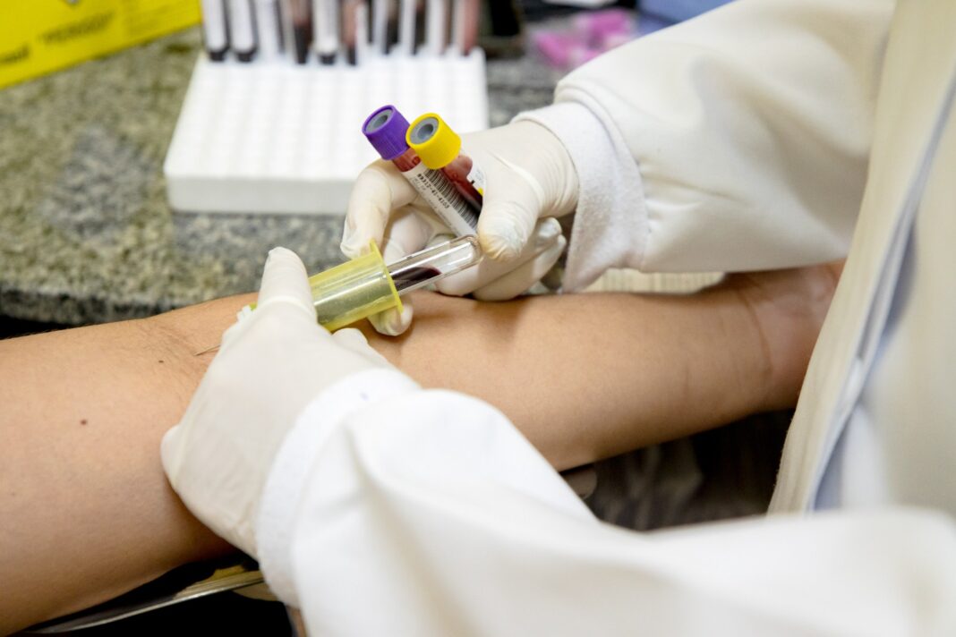 Prefeitura de Manaus inicia oferta de novo teste para diagnosticar tuberculose latente (2)