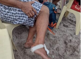 Piranhas atacam banhistas, que ficam feridos em Manaus