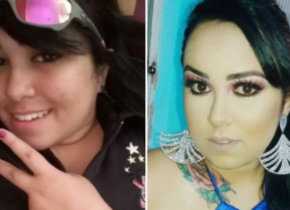 Jovem de 23 anos morre após extração do siso e vítima de infecção