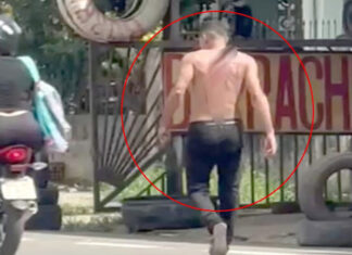Homem caminha tranquilamente com faca cravada nas costas; veja o vídeo