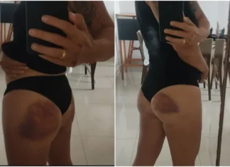 Policial agredida em curso da PM diz que foi pressionada a retornar a treinamento