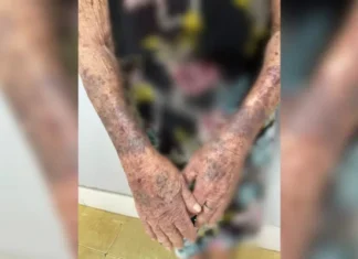 Idoso é preso por manter a mãe em condições subumanas: “Deplorável”