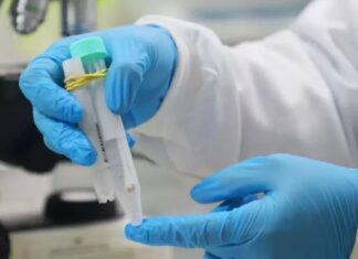 Mpox: Informe epidemiológico mensal atualiza situação da doença no Amazonas