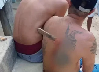 Homem esfaqueado após discussão fica com faca cravada nas costas
