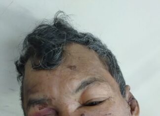 Hospital João Lúcio pede ajuda para encontrar familiares de paciente internado