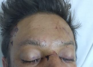SES-AM pede ajuda para encontrar familiares de paciente internado no HPS João Lúcio