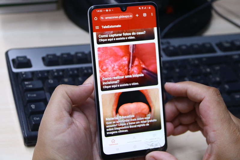 SES_AM_ aplicativo para identificar casos suspeitos de câncer bucal_Foto Evandro Seixas SES (2)