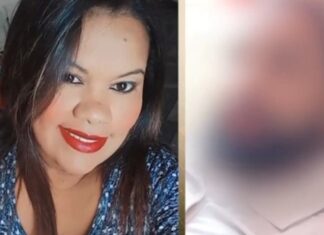Revoltante: Mulher tem todos os ossos do rosto quebrados por marido
