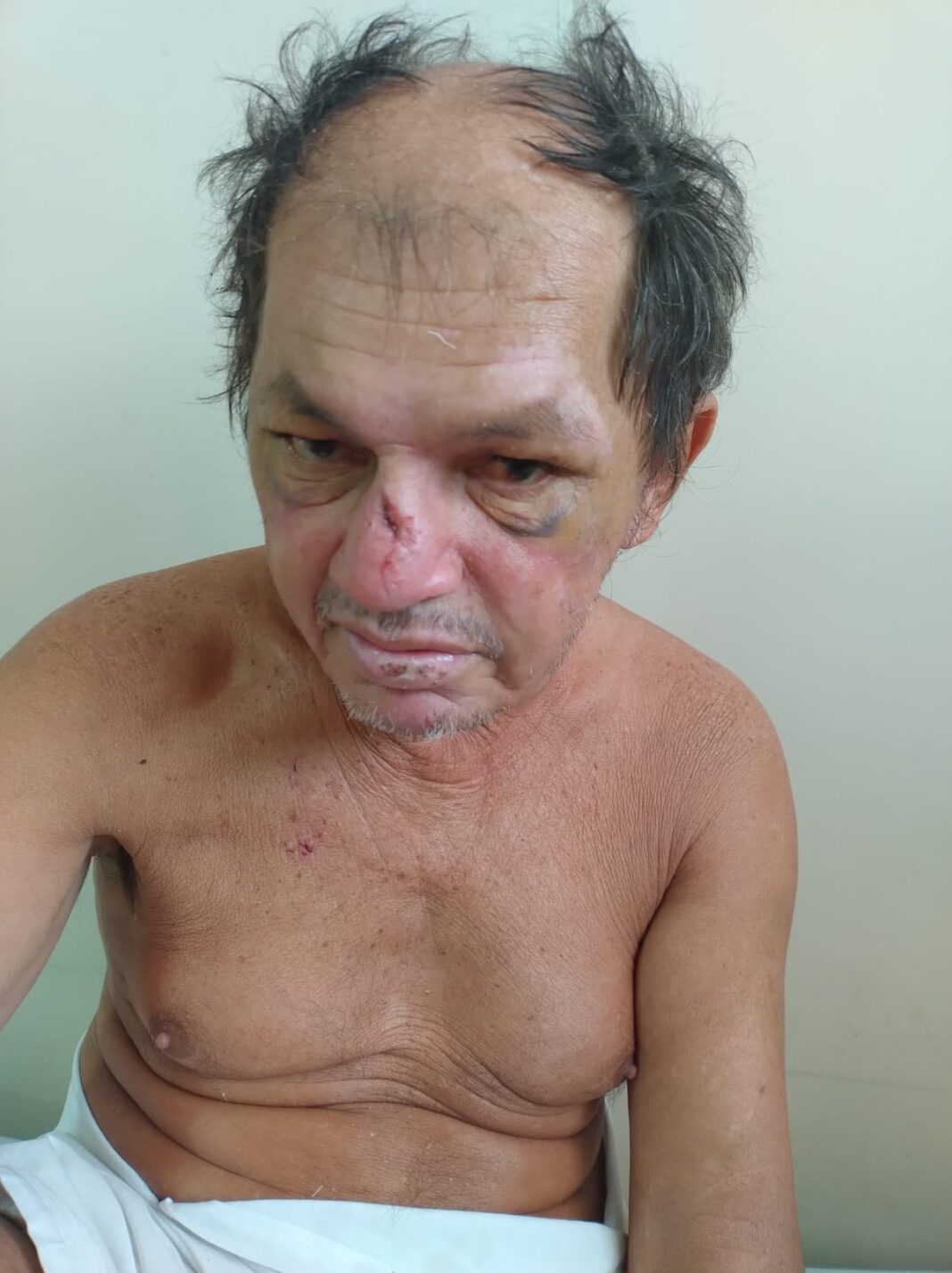SAUDE_HPS_JOAOLUCIO_PROCURA_FAMILIARES_FOTO_DIVULGAÇÃO-SES-AM