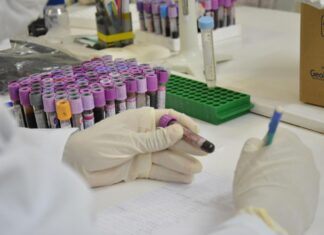 Polícia Científica do Amazonas adere à campanha nacional de coleta de DNA para ajudar a encontrar pessoas desaparecidas
