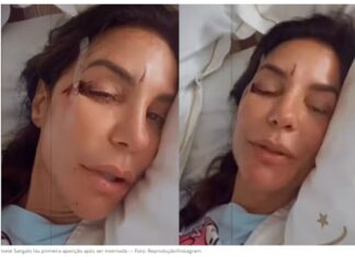 Ivete Sangalo surge em hospital com machucados no rosto e relata susto: ‘Desmaiei’