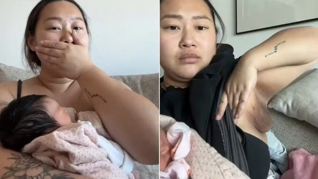 mulher-desenvolve-terceiro-seio-apos-dar-a-luz_widexl