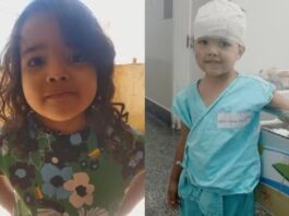 Menina de 4 anos é atacada por pit bull dentro de casa e fica ferida na cabeça