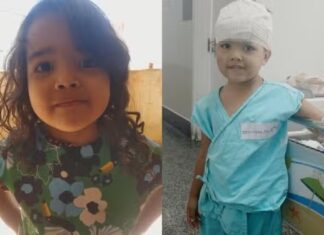 Menina de 4 anos é atacada por pit bull dentro de casa e fica ferida na cabeça