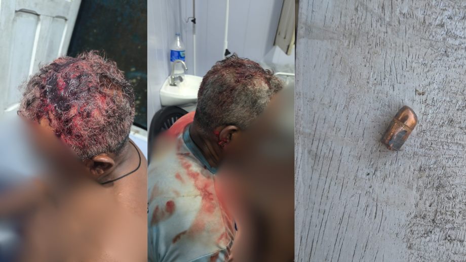 Liderança de 67 anos agredida
