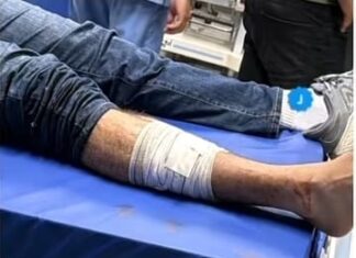 Capitão da PM é baleado de raspão antes de evento com o governador em Manaus