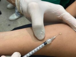 Prefeitura de Manaus amplia oferta do teste tuberculínico para 55 unidades de saúde na capital